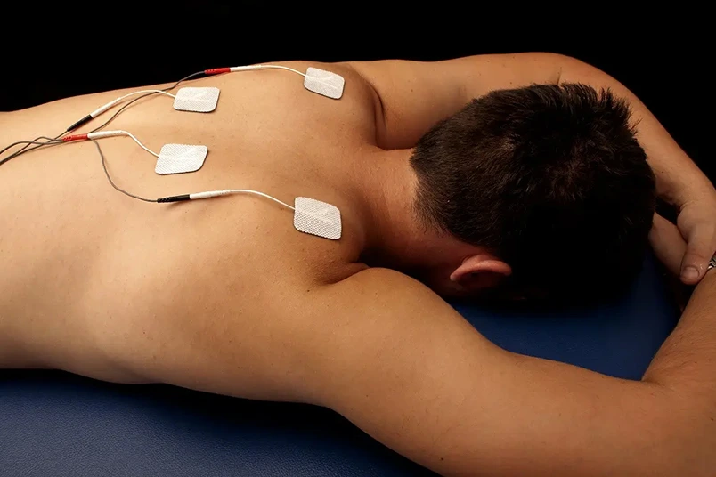 Electrical Stimulation 804x536