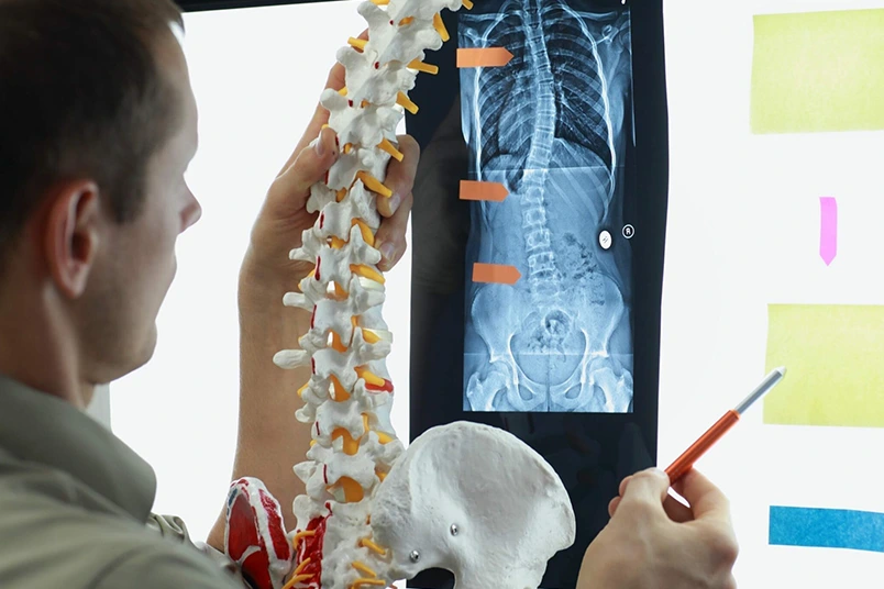 Spinal Screening 804x536